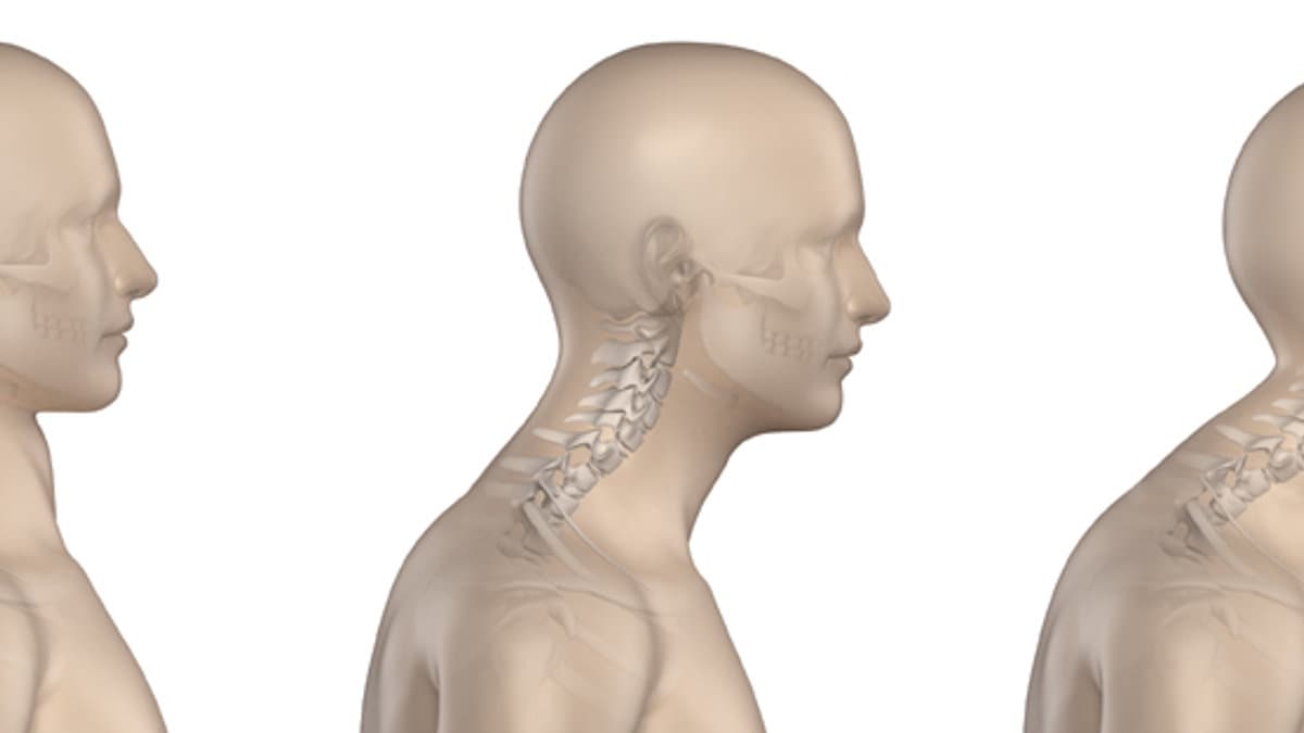 Person sitting upright with good posture